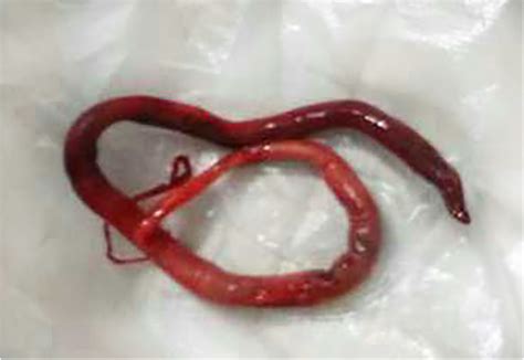 Created for people with ongoing healthcare needs but benefits everyone. . Worms in urine male